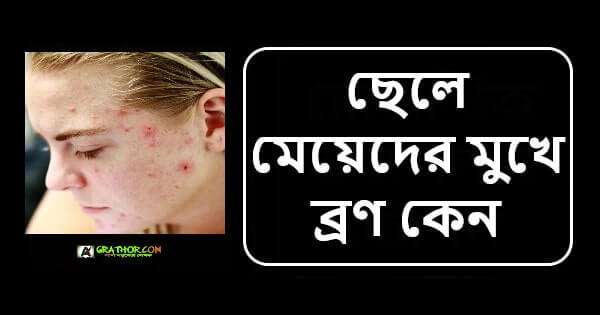 মেয়েদের মুখে ব্রণ কেন হয় ব্রণ দূর করার সহজ উপায়