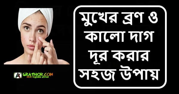 মুখের ব্রণ ও কালো দাগ দূর করার সহজ উপায়