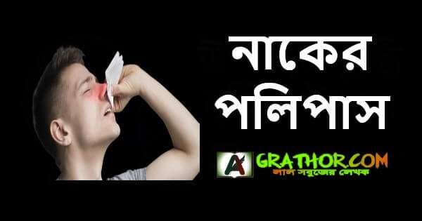 নাকের নাসা দূর করার উপায়, পলিপাস নিরাময়