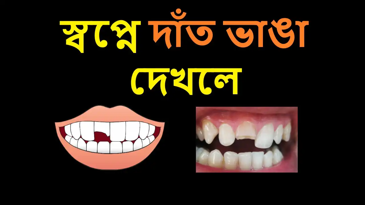 স্বপ্নে দাঁত ভাঙা দেখলে কি হয়